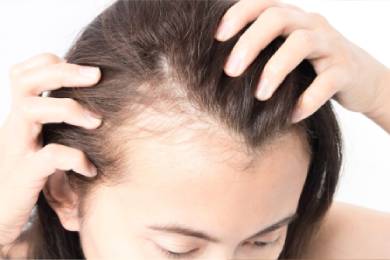 prp for hair loss clinic in anna nagar