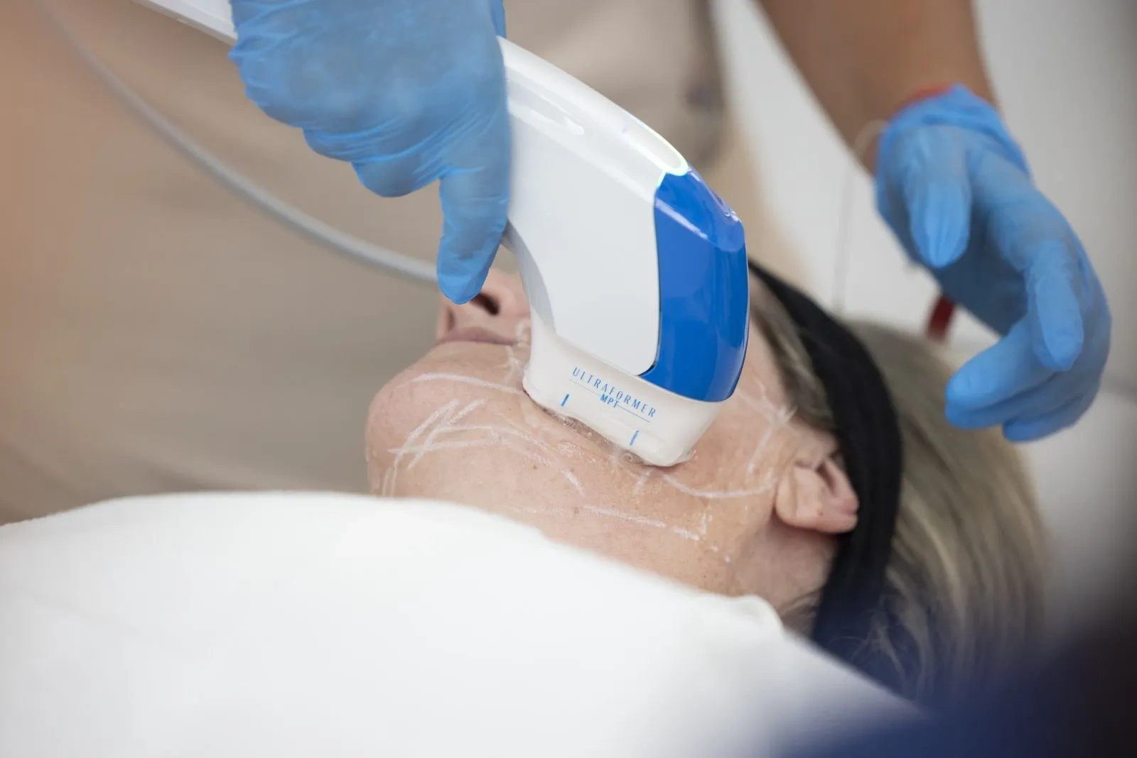 Hifu Treatment in Anna Nagar