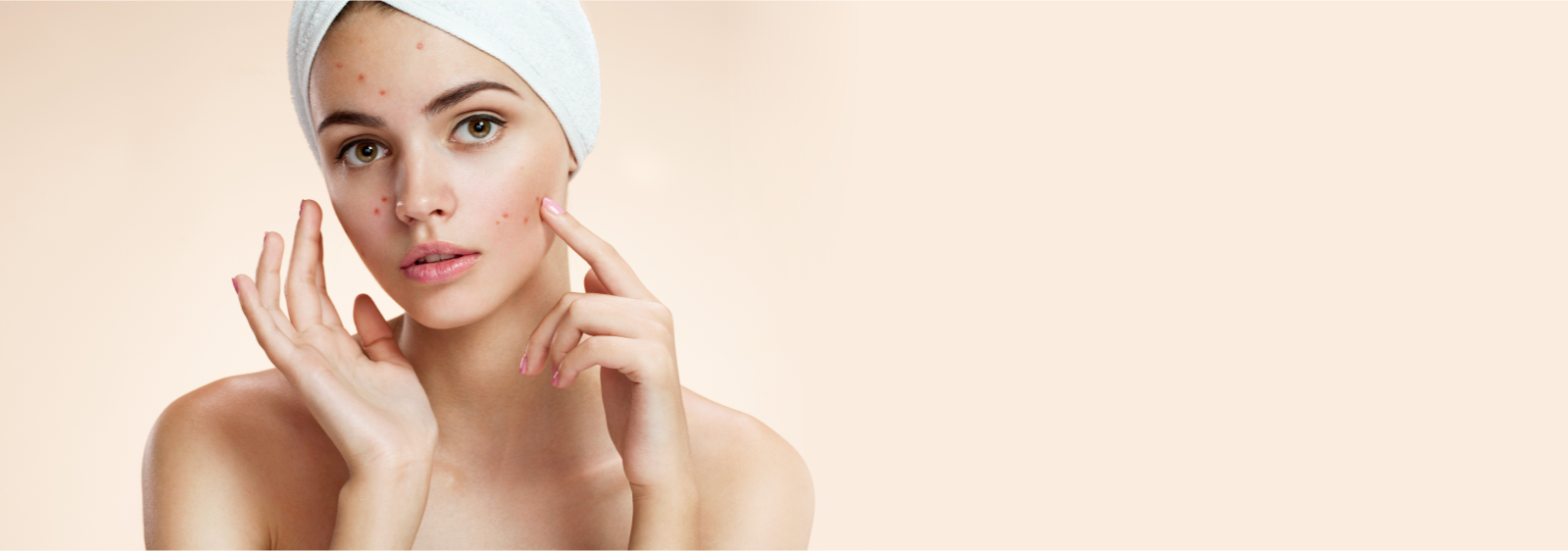 skin care clinic in anna nagar