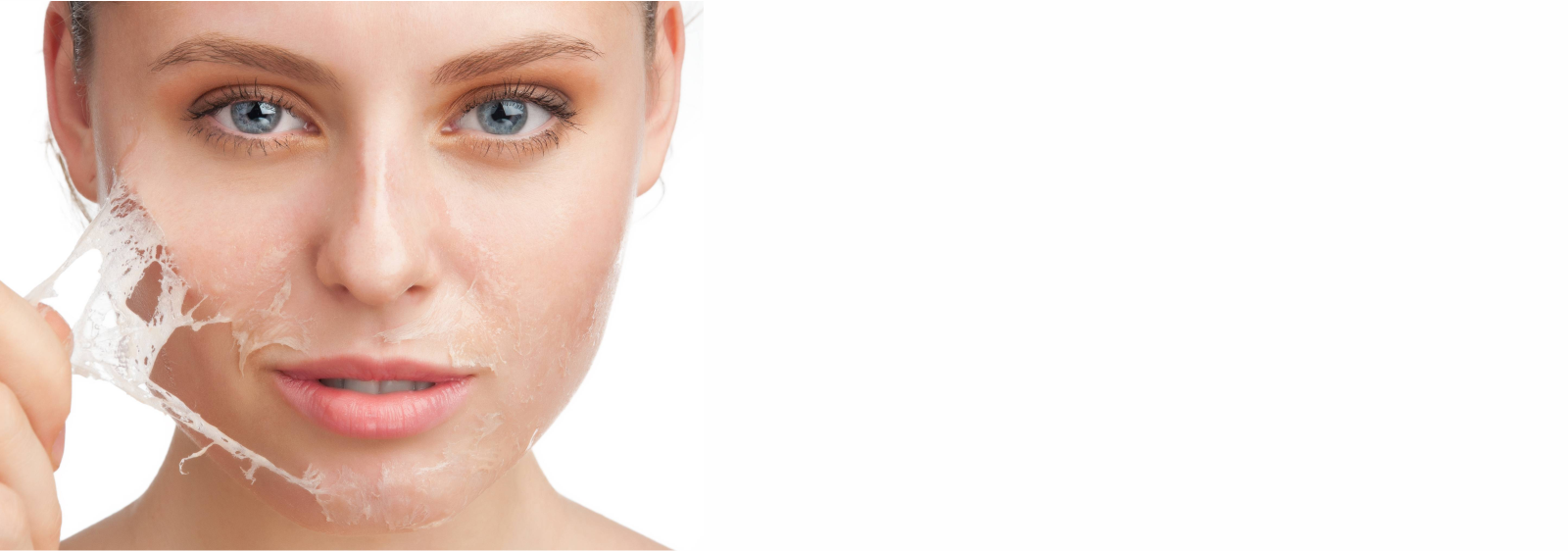 chemical peel Treatment in anna nagar