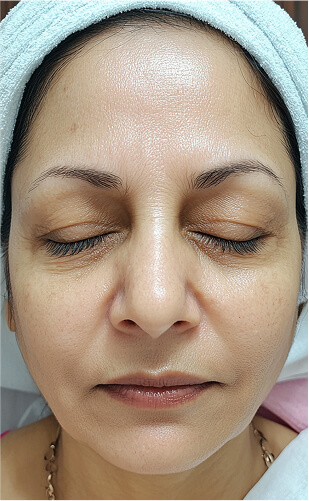 Skin Doctor in Shenoy Nagar